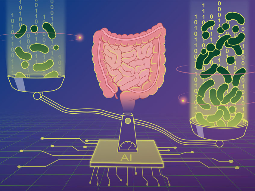 Machine learning links microbiome composition to bacterial load